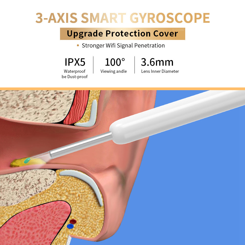 HD otoscope earwax removal tool app